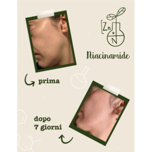 Siero Viso Seboregolatore e Anti-imperfezioni - Niacinamide + Zinco I La Saponaria - immagine 4