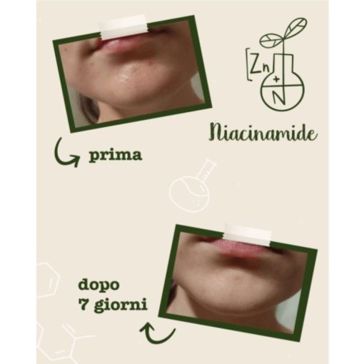 Siero Viso Seboregolatore e Anti-imperfezioni - Niacinamide + Zinco I La Saponaria - immagine 5